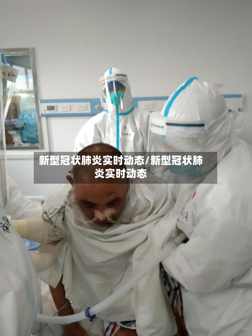 新型冠状肺炎实时动态/新型冠状肺炎实时动态-第1张图片