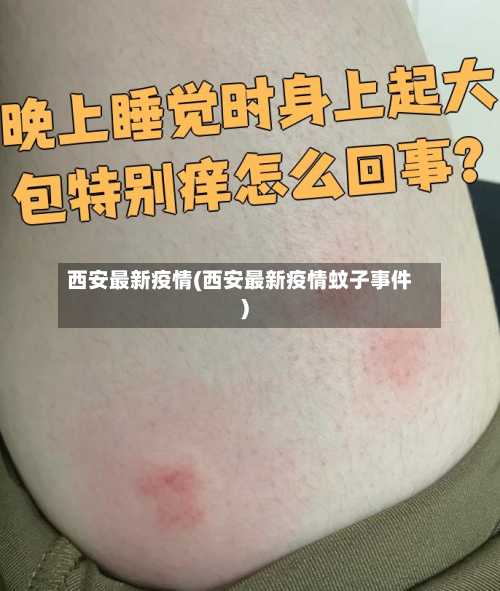 西安最新疫情(西安最新疫情蚊子事件)