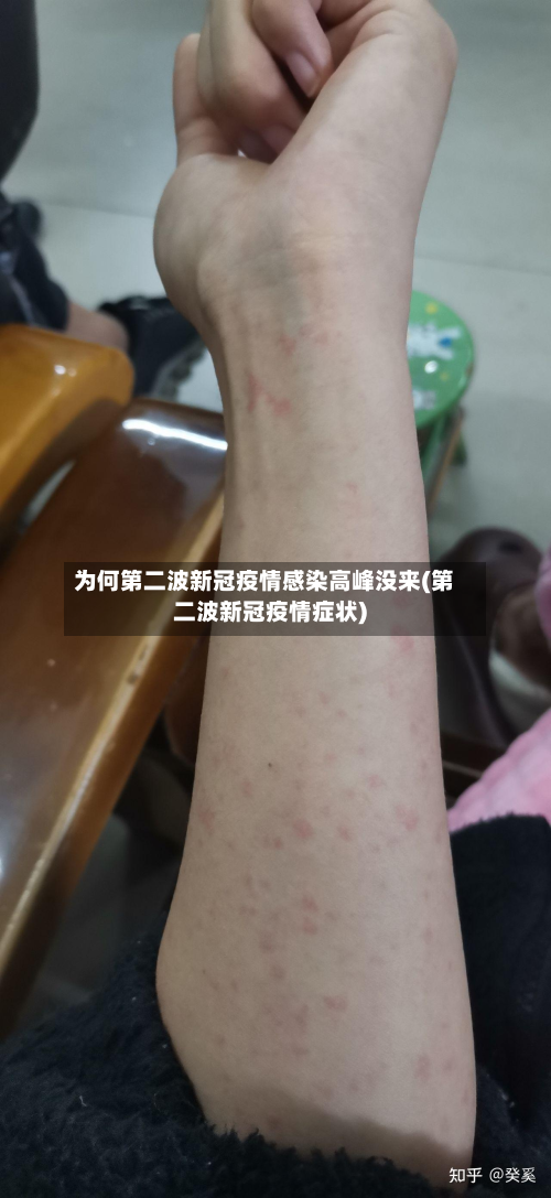 为何第二波新冠疫情感染高峰没来(第二波新冠疫情症状)